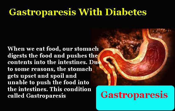 Gastroparesis With Diabetes