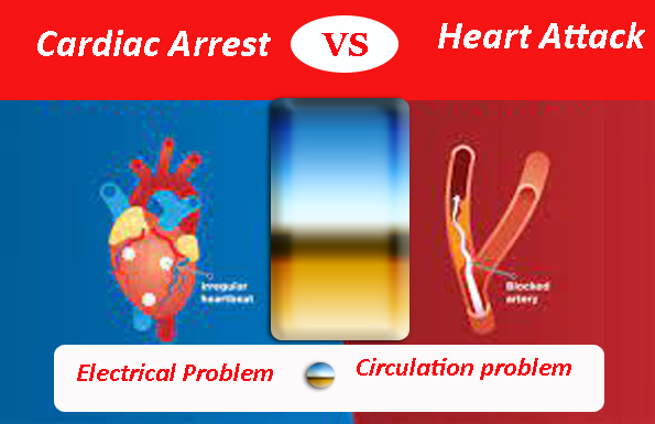 difference between a Heart attack vs Cardiac arrest?